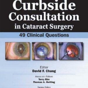 Curbside Consultation in Cataract Surgery