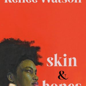 skin & bones book cover